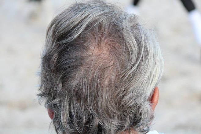 grey hair
